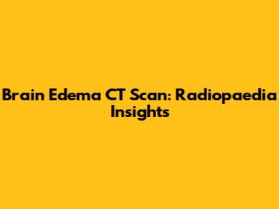 Brain Edema CT Scan: Radiopaedia Insights