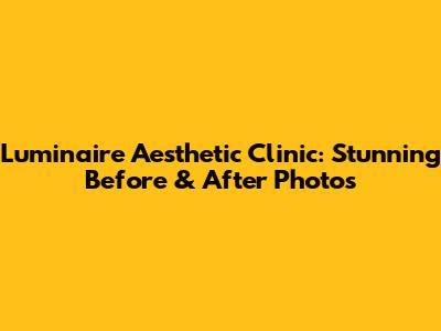 Luminaire Aesthetic Clinic: Stunning Before & After Photos